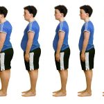تغيرات الوزن غير المتوقعة:   زيادة أو نقصان الوزن
