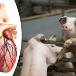 الإنسان وقلب الخنزير