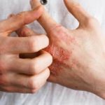 أمراض فصل الربيع