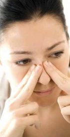 الجيوب الأنفية و التهاباتها 538