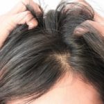 أشهر خرافات عن تساقط الشعر
